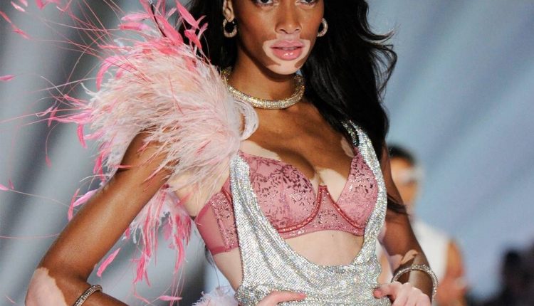 Winnie Harlow shares her weight for the Victoria's Secret Fashion Show

