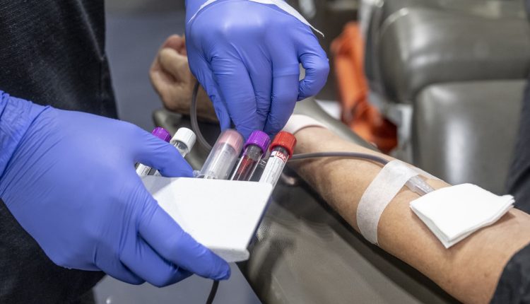 FDA proposal would allow gay men in monogamous relationships to donate blood

