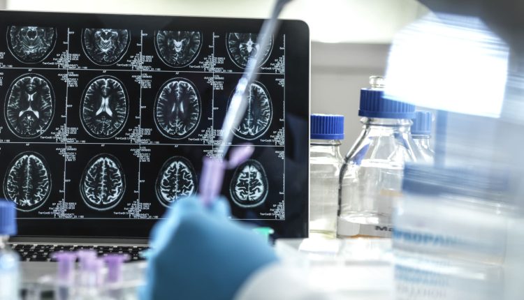 The maker of Alzheimer's drug Leqembi expects full FDA approval this summer

