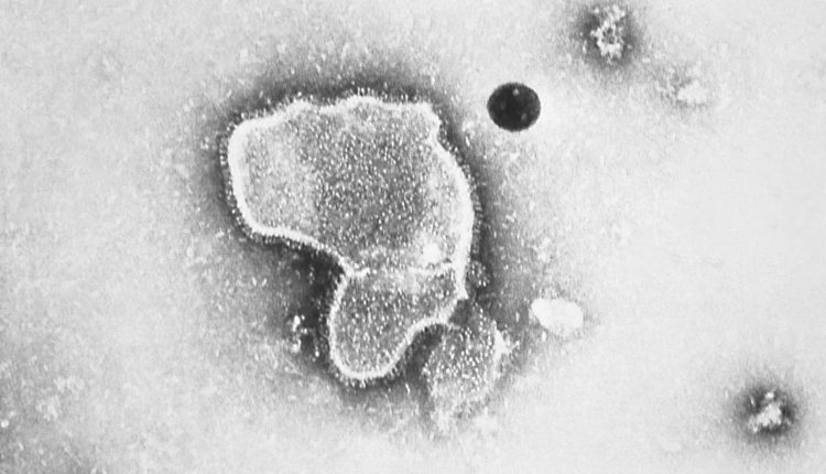 FDA says Guillain-Barre syndrome is a potential risk for a Pfizer RSV vaccine

