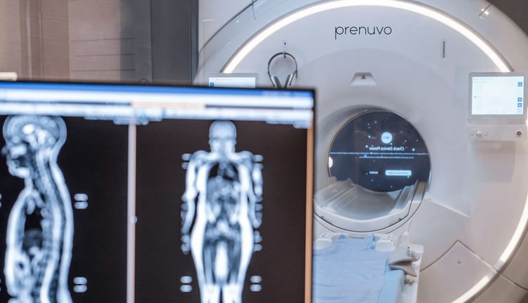 Prenuvo offers $2,500 full-body MRI scans that can detect cancer early