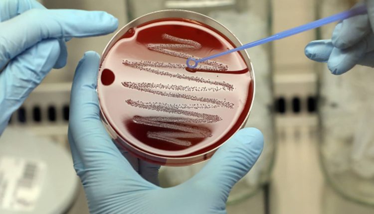 A hotter world makes it harder to stop the spread of superbugs