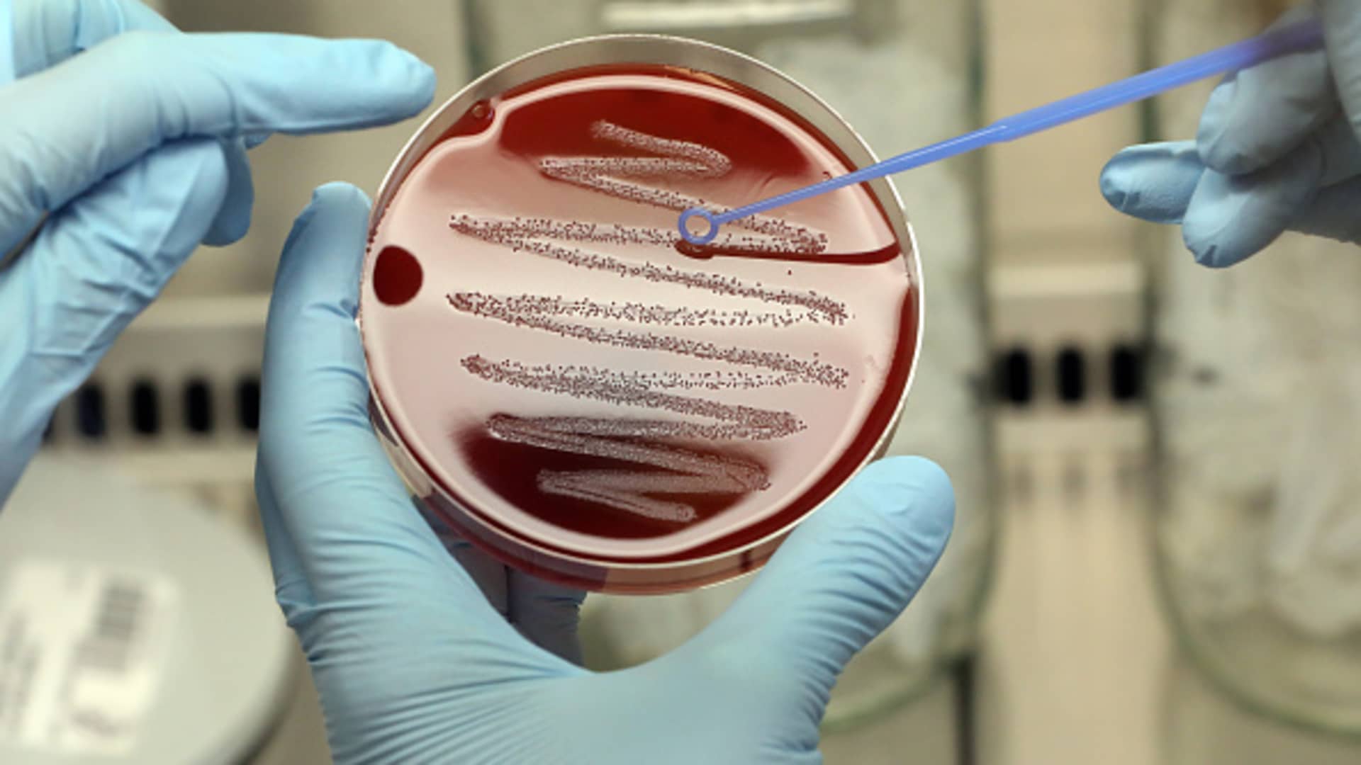 A hotter world makes it harder to stop the spread of superbugs