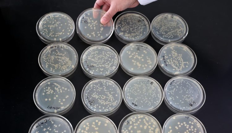 This consumer microbiome startup is betting profits on an AI tool

