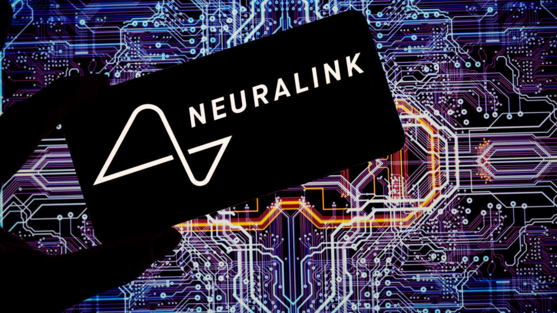Neuralink says its first human brain implant is running into problems
