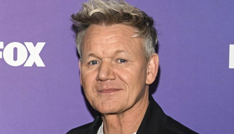 Gordon Ramsay Shows EXTREME Bruise Bicycle Accident Purple Potato 