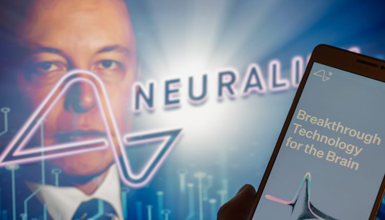 Musk says next Neuralink brain implant expected “about next week”

