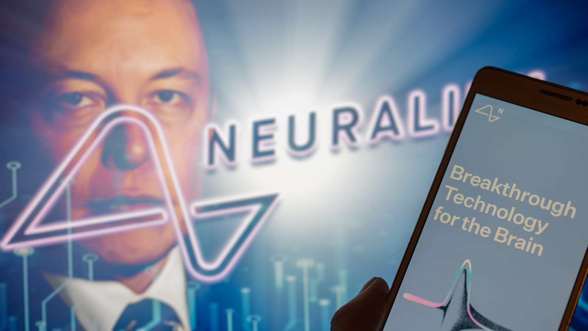 Musk says next Neuralink brain implant expected “about next week”