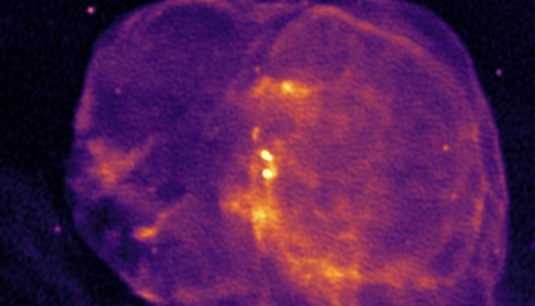 Radio image from the MeerKAT telescope showing Circinus X-1 in the center, within the spherical remnant of the supernova it was born in. The shock waves caaued by the jets are seen above and below Cir X-1, and the S-shape structure in the jets is somewhat obscured by a bright source in the background. Courtesy Fraser Cowie, Attribution CC BY 4.0.