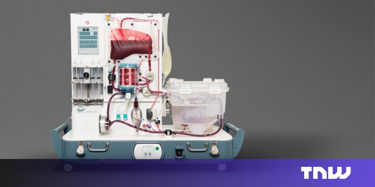 Technology companies collect the bizarre science of organ solving