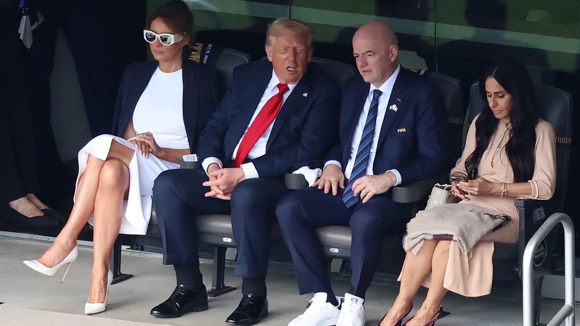 Trump diagnoses chronic venous insufficiency